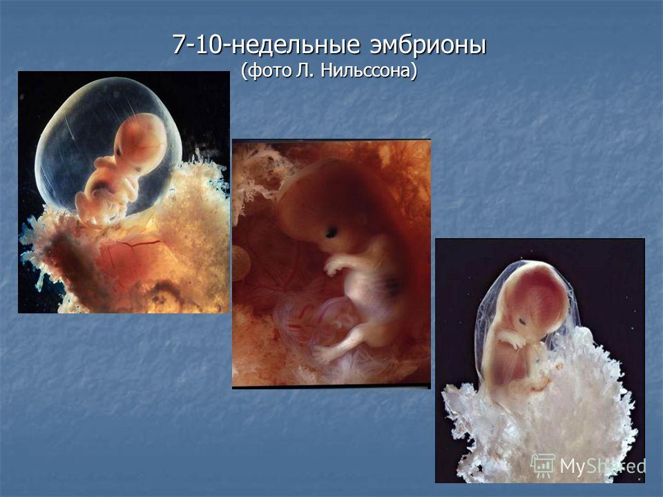 Про 6 неделю. Эмбрион человека 4-6 недель. Человеческий эмбрион на ранних этапах.