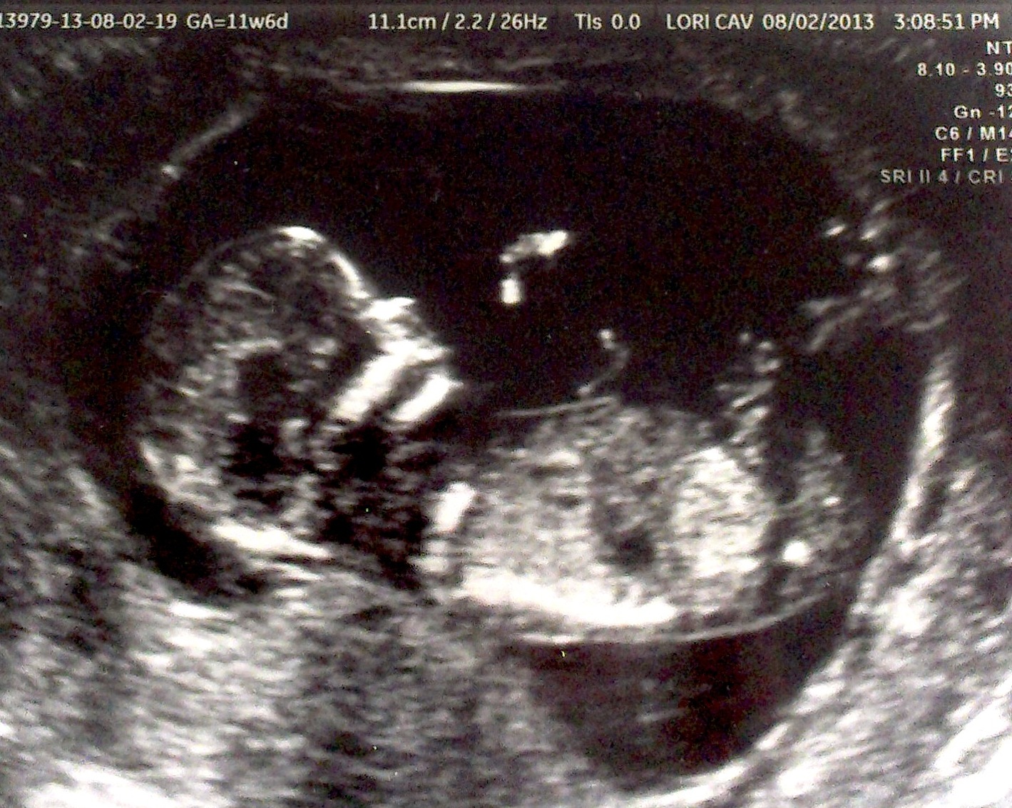 3 недели беременности фото плода как выглядит