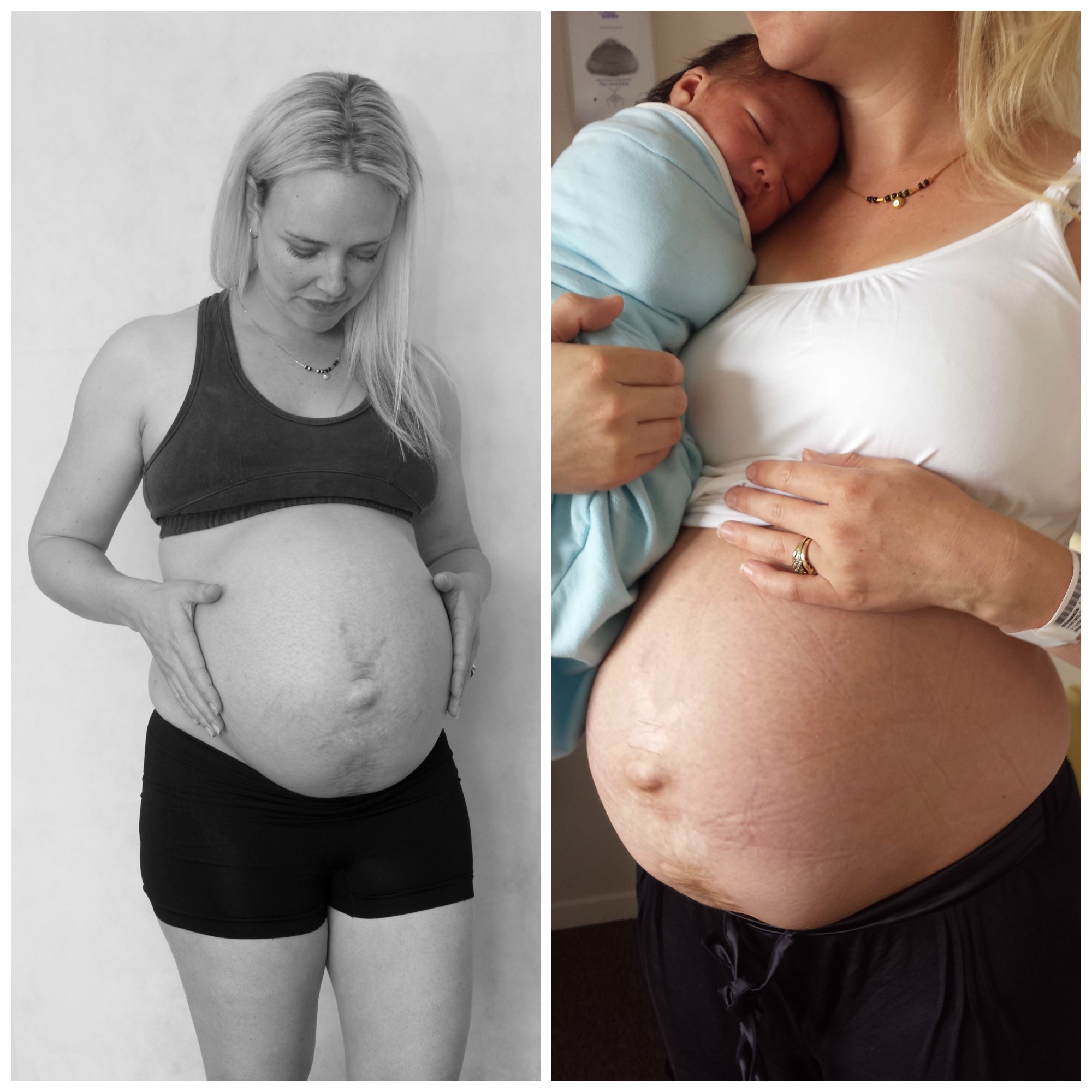 6 недель после родов. Женщины беременные двойней. Животы беременных двойней. Живот на 37 неделе беременности. Как выглядят беременные женщины.