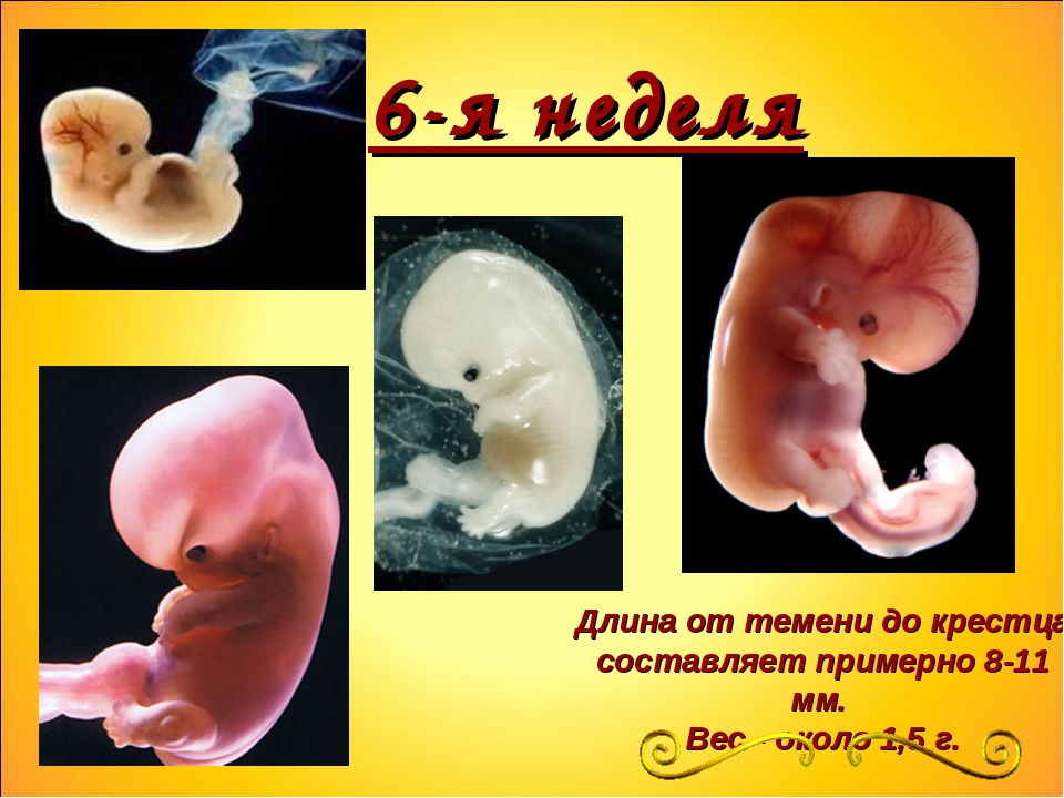 6 эмбриональная неделя. Развитие эмбриона человека по неделям. 5 Недельный зародыш человека.