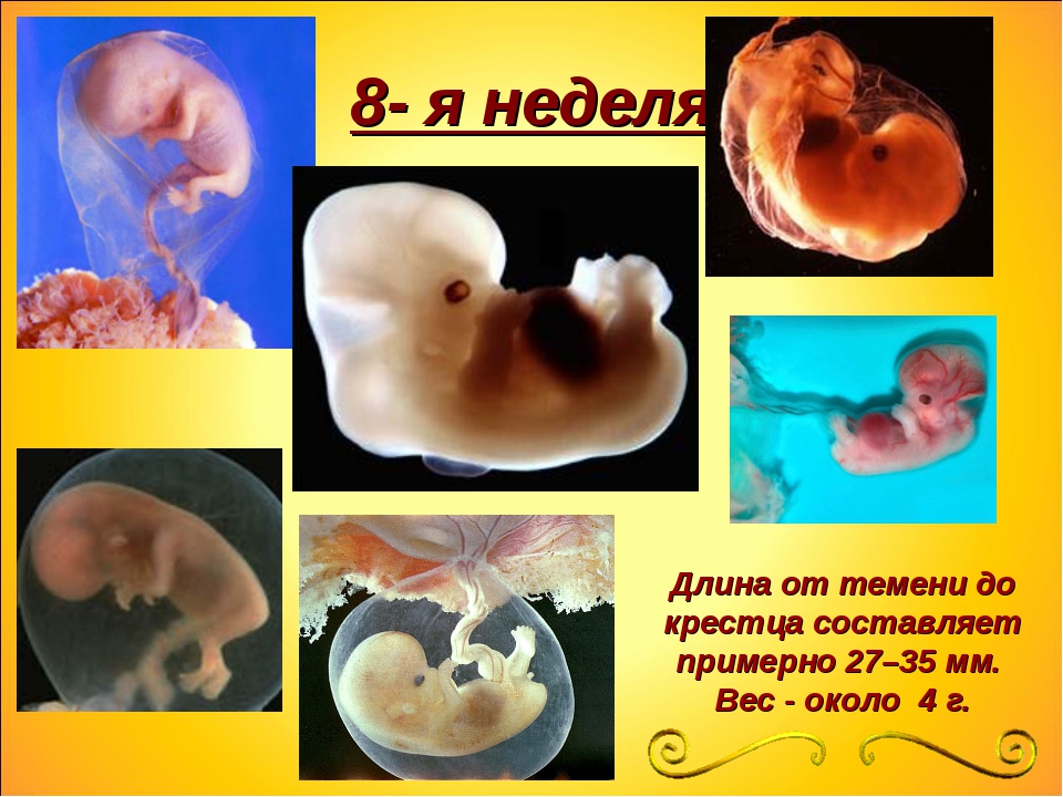 Россия 8 недель. Плод 7-8 недель беременности.