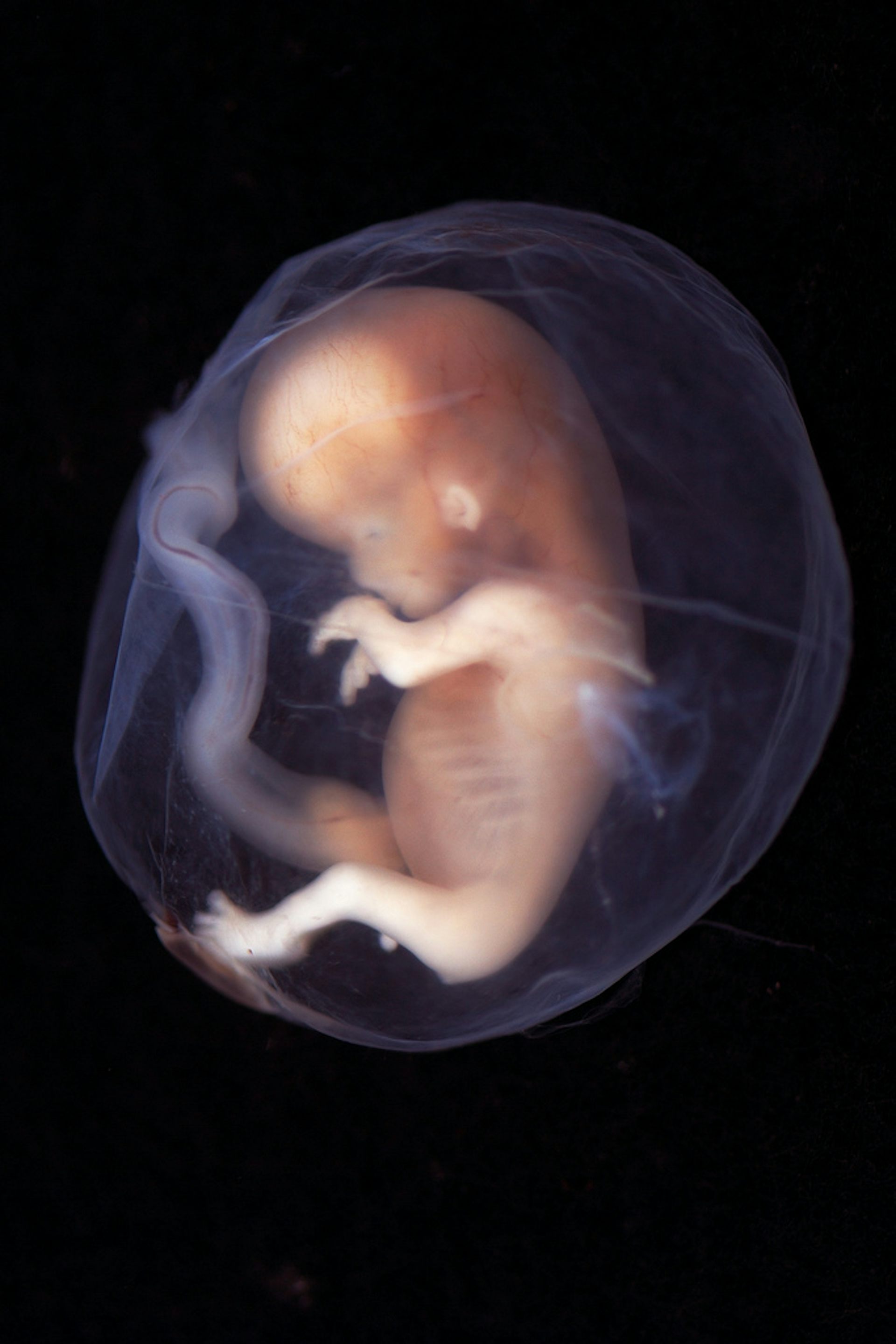 Недельный плод. Эмбрион на 9 неделе беременности фото. Эмбрион на 10 неделе беременности. Эмбрион на 9-10 неделе беременности.