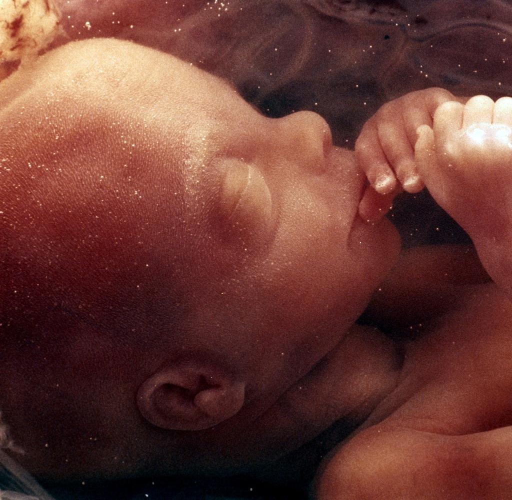14 недель беременности грудь форум фото 95