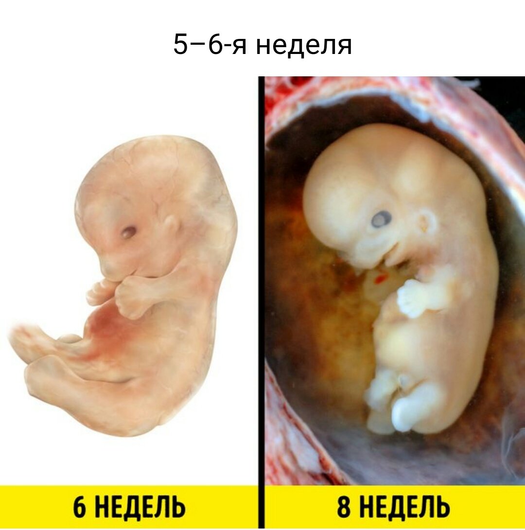 Ребенок в утробе 8 недель
