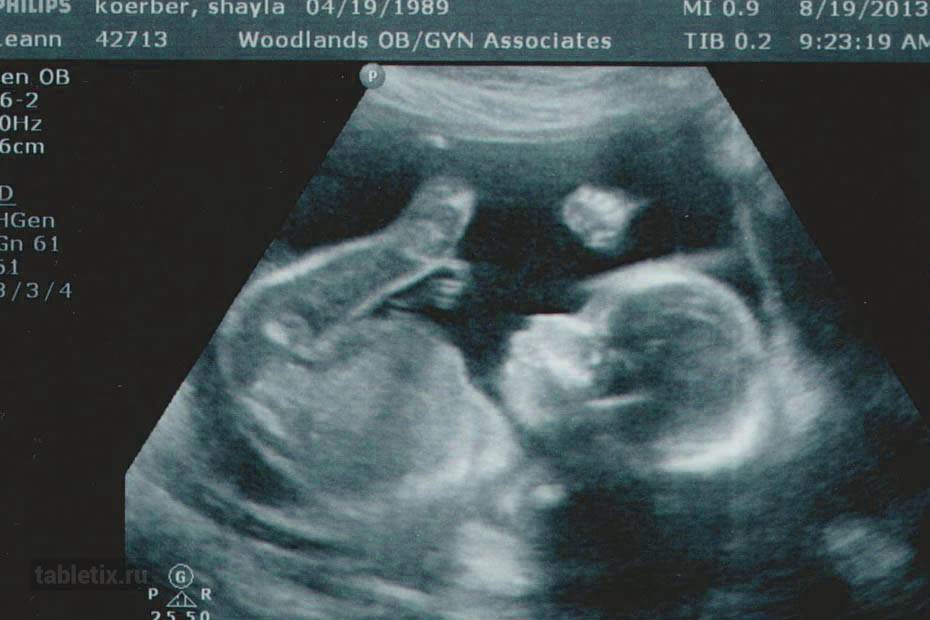 Беременность 21. УЗИ плода 21 неделя беременности. Как выглядит малыш на УЗИ на 21 неделе.